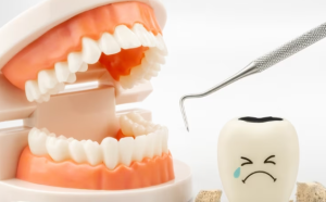 Penyebab Gigi Sensitif Kenali dan Atasi Sebelum Terlambat